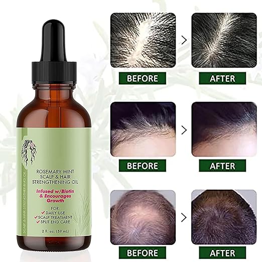 BONK Rosemary Oil for Hair and Scalp - Natural Mint Oil Stimulates Hair Growth Against Hair Loss - 2 oz 59 ml (Pack of 2)